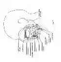 Fig. 141 - Obstructive sleep apnea treatment devices, systems and methods
