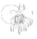 Fig. 145 - Obstructive sleep apnea treatment devices, systems and methods