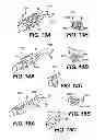 Fig. 16 - Obstructive sleep apnea treatment devices, systems and methods