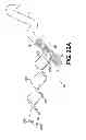 Fig. 22 - Obstructive sleep apnea treatment devices, systems and methods