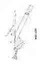 Fig. 28 - Obstructive sleep apnea treatment devices, systems and methods