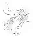 Fig. 33 - Obstructive sleep apnea treatment devices, systems and methods