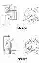 Fig. 35 - Obstructive sleep apnea treatment devices, systems and methods