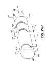 Fig. 37 - Obstructive sleep apnea treatment devices, systems and methods