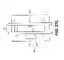 Fig. 40 - Obstructive sleep apnea treatment devices, systems and methods