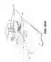 Fig. 43 - Obstructive sleep apnea treatment devices, systems and methods