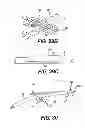 Fig. 44 - Obstructive sleep apnea treatment devices, systems and methods