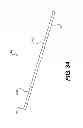 Fig. 47 - Obstructive sleep apnea treatment devices, systems and methods