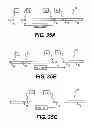 Fig. 48 - Obstructive sleep apnea treatment devices, systems and methods