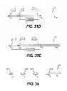 Fig. 49 - Obstructive sleep apnea treatment devices, systems and methods