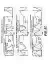 Fig. 67 - Obstructive sleep apnea treatment devices, systems and methods