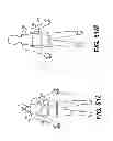 Fig. 76 - Obstructive sleep apnea treatment devices, systems and methods