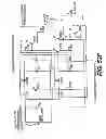 Fig. 82 - Obstructive sleep apnea treatment devices, systems and methods