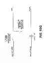 Fig. 83 - Obstructive sleep apnea treatment devices, systems and methods
