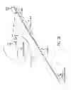 Fig. 90 - Obstructive sleep apnea treatment devices, systems and methods