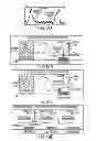 Fig. 98 - Obstructive sleep apnea treatment devices, systems and methods
