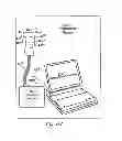 Fig. 99 - Obstructive sleep apnea treatment devices, systems and methods
