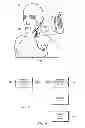 Fig. 05 - Methods, systems, and devices for pairing vagus nerve stimulation with motor therapy in stroke patients