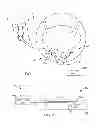 Fig. 02 - Implantable electrode assembly