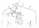 Fig. 01 - Cuff electrode with integrated tendril