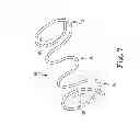 Fig. 06 - Cuff electrode with integrated tendril