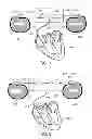 Fig. 02 - Implantable lead connector