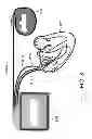 Fig. 06 - Implantable lead connector