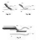 Fig. 08 - Vestibular stimulation electrode