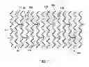 Fig. 02 - MODIFIED SCAFFOLDS FOR PERIPHERAL APPLICATIONS