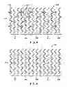 Fig. 04 - MODIFIED SCAFFOLDS FOR PERIPHERAL APPLICATIONS