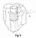 Fig. 06 - Methods for modifying vascular vessel walls