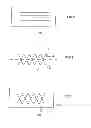 Fig. 02 - Intravascular functional element and method of manufacture