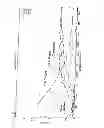 Fig. 04 - Intravascular functional element and method of manufacture