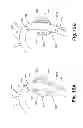 Fig. 16 - Endoprosthesis assemblies and methods to use the same