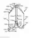 Fig. 01 - Expandable Support Frame and Medical Device