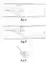 Fig. 04 - Peripheral sealing venous check-valve