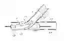 Fig. 01 - Vascular bifurcation prosthesis