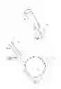 Fig. 02 - Vascular bifurcation prosthesis
