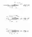 Fig. 10 - Vascular bifurcation prosthesis