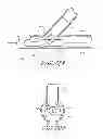 Fig. 16 - Vascular bifurcation prosthesis