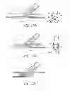 Fig. 18 - Vascular bifurcation prosthesis