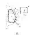 Fig. 02 - METHODS FOR AUGMENTING OR RECONSTRUCTING A HUMAN BREAST