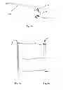 Fig. 02 - Dilator for inserting a voice prosthesis