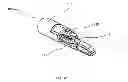 Fig. 06 - Dilator for inserting a voice prosthesis