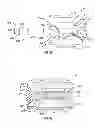 Fig. 23 - Expandable fusion device and method of installation thereof