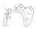 Fig. 01 - MULTI-COMPONENT SHOULDER IMPLANT ASSEMBLY WITH DUAL ARTICULATING SURFACES
