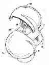 Fig. 01 - Artificial wear resistant plug for mounting to existing joint bone