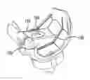 Fig. 01 - PROSTHETIC IMPLANTS FOR TOTAL KNEE ARTHROPLASTY