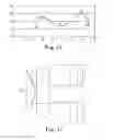 Fig. 07 - PROSTHETIC IMPLANTS FOR TOTAL KNEE ARTHROPLASTY