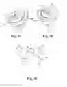 Fig. 10 - PROSTHETIC IMPLANTS FOR TOTAL KNEE ARTHROPLASTY